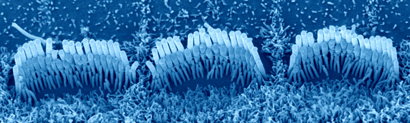 Illustration for article titled Promising Study Shows the Power of Gene Therapy to Treat Deafness